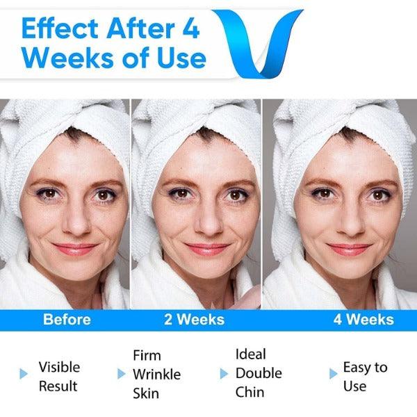 https://cdn.shopify.com/s/files/1/0943/8845/3718/files/Double_Chin_Massager_-_Electric_V-Face_Shaping_Massage_Face_Lifting_Slim_Double_Chin_Removal_Machine_7.jpg?v=1773412853